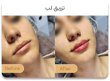 After image